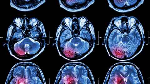 Brain scans