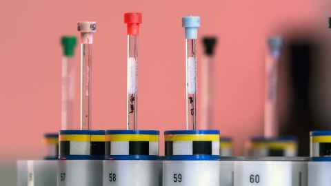NMR