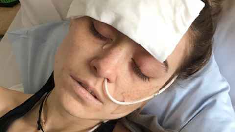 Ruby Hill asleep in a hospital bed with a nasal gastric tube