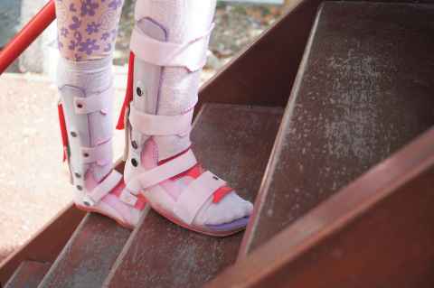 Legs of child with cerebral palsy wearing leg braces walking up steps